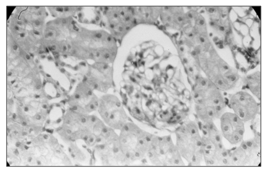 New Hope to Fight Renal Calcium Oxalate Stones by Herbal Extract