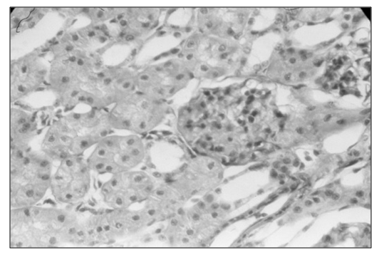 New Hope to Fight Renal Calcium Oxalate Stones by Herbal Extract