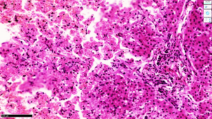 Morphological Changes of the Liver of Infants Born in Pregnancy with ...