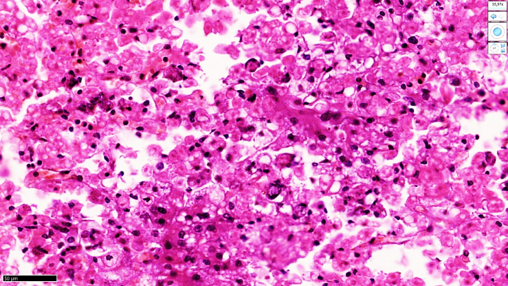 Morphological Changes of the Liver of Infants Born in Pregnancy with ...